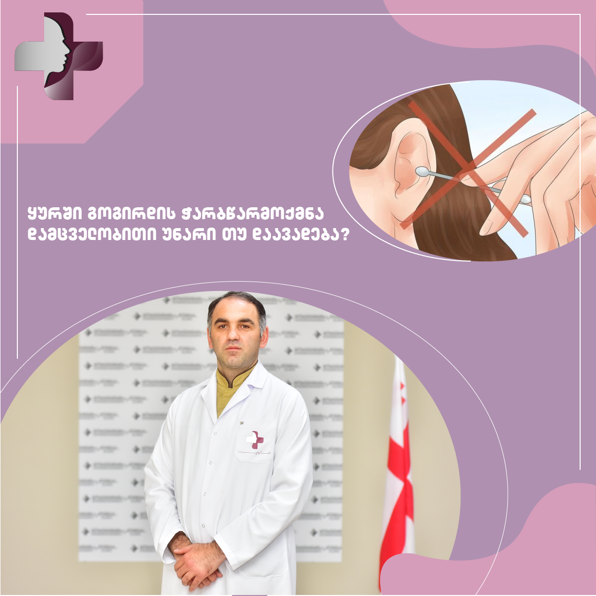 ყურში გოგირდის ჭარბწარმოქმნა